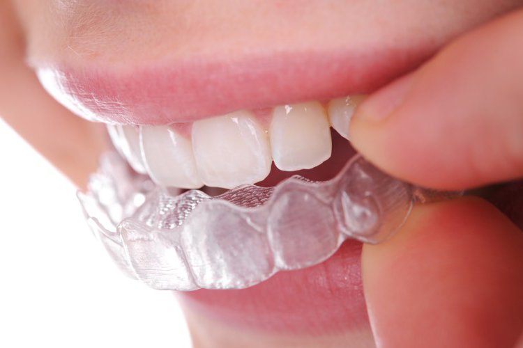 About lakenona orthodontics